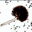 Aspergillus Aspergillus