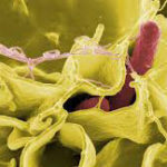 Salmonella